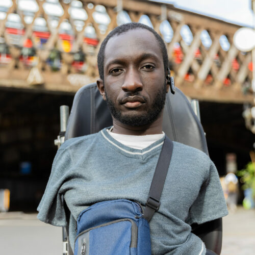 A Black man with upper and lower limb differences stares into the camera. Behind him is a railway bridge with a train moving across it.